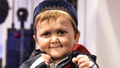 Hasbulla’s condition explained as people still confused about how old he is
