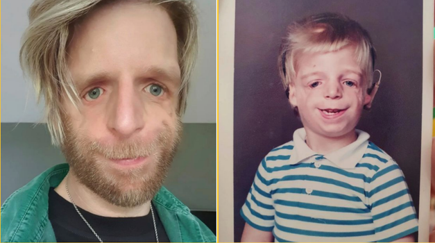 Man was abandoned at birth by parents because they didn’t like his face