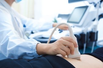 Mum refuses to tell partner gender of their baby after he skipped scan to go to the chippy