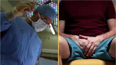 Surgeon amputates patient’s penis thinking it was a tumour