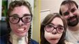 Dogsitter reveals results of reconstructive surgery after most of her face was torn off in dog attack