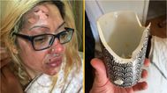 Mum left in ‘agony’ after following viral TikTok poached egg ‘hack’