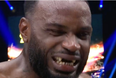 Kickboxer loses row of front teeth in horror incident during fight