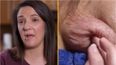 Woman has surgery to have ‘third arm’ removed – only for it to grow back even bigger