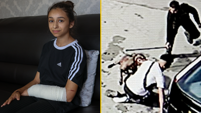 Girl, 11, attacked by XL bully in Birmingham says the dog should be put down and its owner jailed