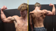 Lad praised for sharing why his right arm is much bigger than his left