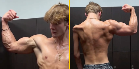 Lad praised for sharing why his right arm is much bigger than his left