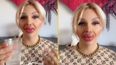 Woman who’s undergone huge lip injections says it’s difficult to eat and drink