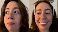 Woman horrified after applying clip-in veneers for her wedding