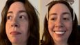 Woman horrified after applying clip-in veneers for her wedding