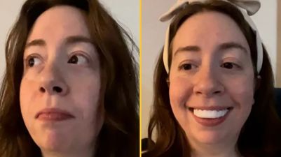 Woman horrified after applying clip-in veneers for her wedding