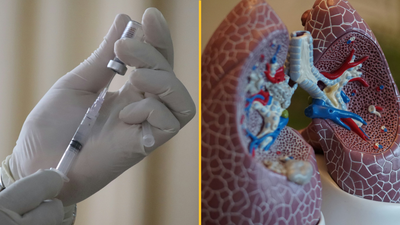 ‘Groundbreaking’ lung cancer vaccine in development