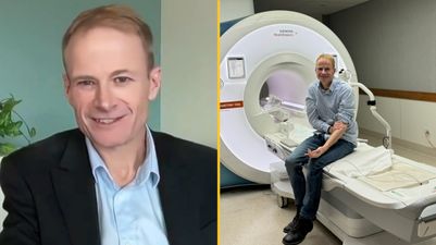 Doctor remains cancer-free one year after using treament he developed for terminal brain tumor