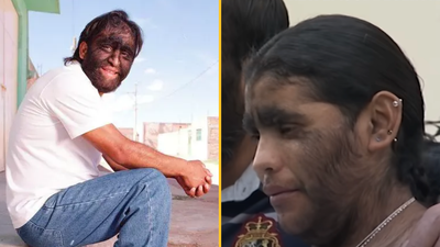 People rush to defend world’s hairiest family as trolls brand them with cruel nickname