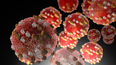 Measles outbreak in the US surpasses 700 cases with lots of patients under 18