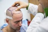 Scientists claim they can cure baldness