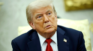 Donald Trump has been diagnosed with chronic venous insufficiency