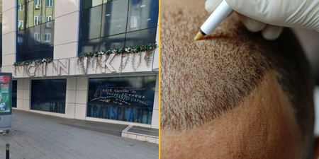Brit tourist dies in Turkey after hair transplant goes wrong