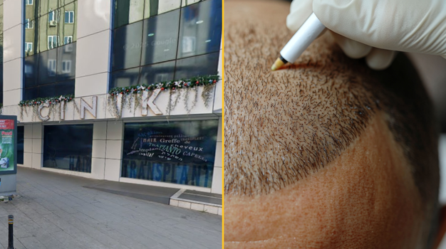 Brit tourist dies in Turkey after hair transplant goes wrong - JOE.co.uk